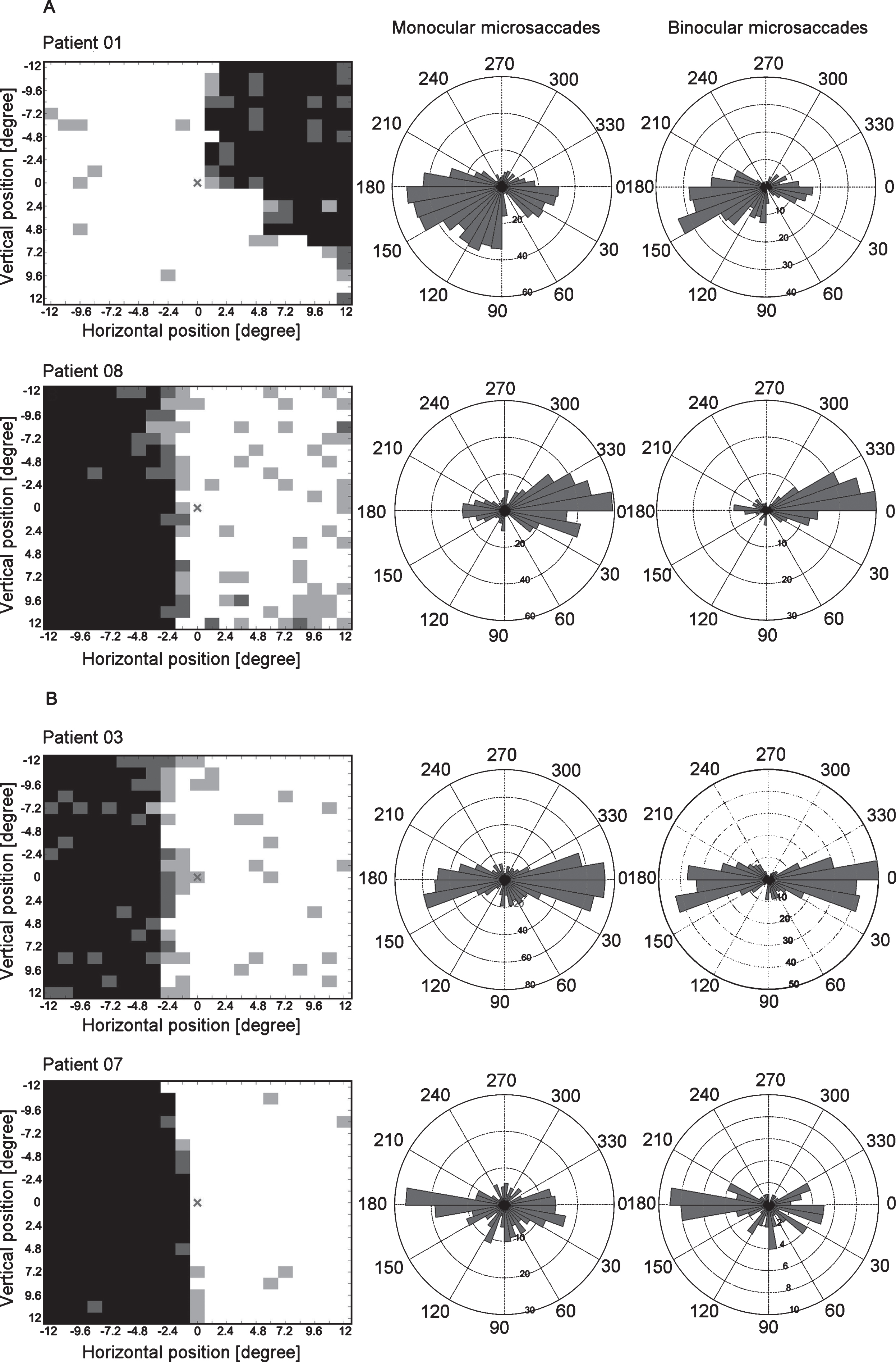 HRP visual charts, monocular and binocular microsaccade angular histograms of representative hemianopia cases of the biased (A) and the non-biased group (B). The HRP visual charts (first column) and angular histograms of monocular (second column) and binocular (third column) microsaccades from four patients with hemianopia (two in each subgroup) are presented. In the biased group, the angular histograms show more microsaccades towards the intact area. In the non-biased group, the angular histograms show no specific bias of microsaccade direction towards the blind or intact areas. Note: The angular histograms do not convey information about microsaccade amplitudes. Bar length rather represents microsaccade numbers.