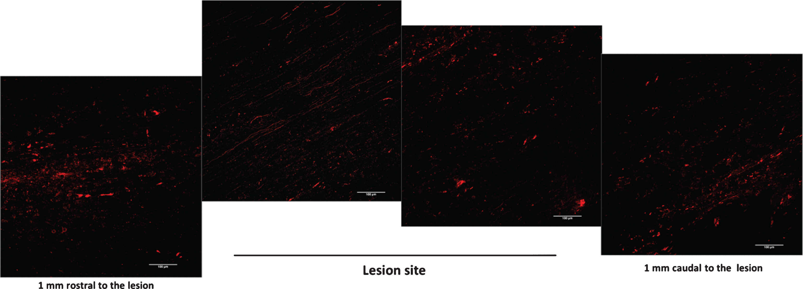 Detail of anterograde axonal labelling relative to Er-NPCs transplanted animals (at 30 days). The reconstruction is referring to longitudinal sections of lesion site epicenter (T9) and 1 mm away from the lesion. Scale bars = 100 μm.