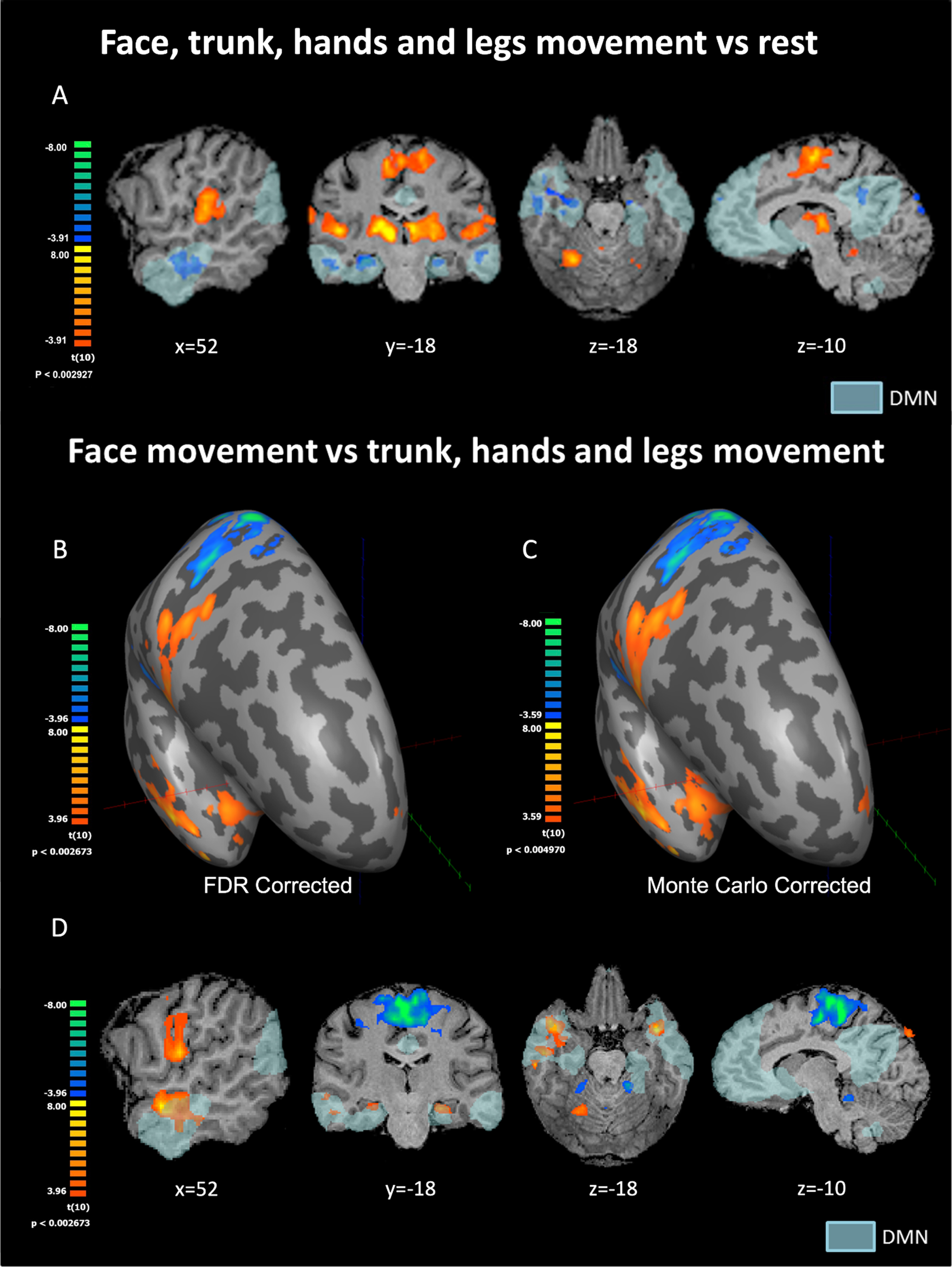 (A) Statistical parametric maps for movement of all body parts relative to rest condition following FDR correction. (B, C, D) Statistical parametric maps for face-movement relative to the movement of all other body parts. Results are presented on the inflated right hemisphere following FDR correction (B) and Monte Carlo correction (C), as well as on volume-based maps (D). The most intriguing activation pattern can be seen in B–D with strong face selectivity in the TP and Hip parts of the DMN. TP = temporal pole, Hip = hippocampus, PCC = posterior cingulate cortex, M1 = primary motor cortex, DMN = default mode network. DMN in light blue as derived from resting-state functional connectivity analysis.
