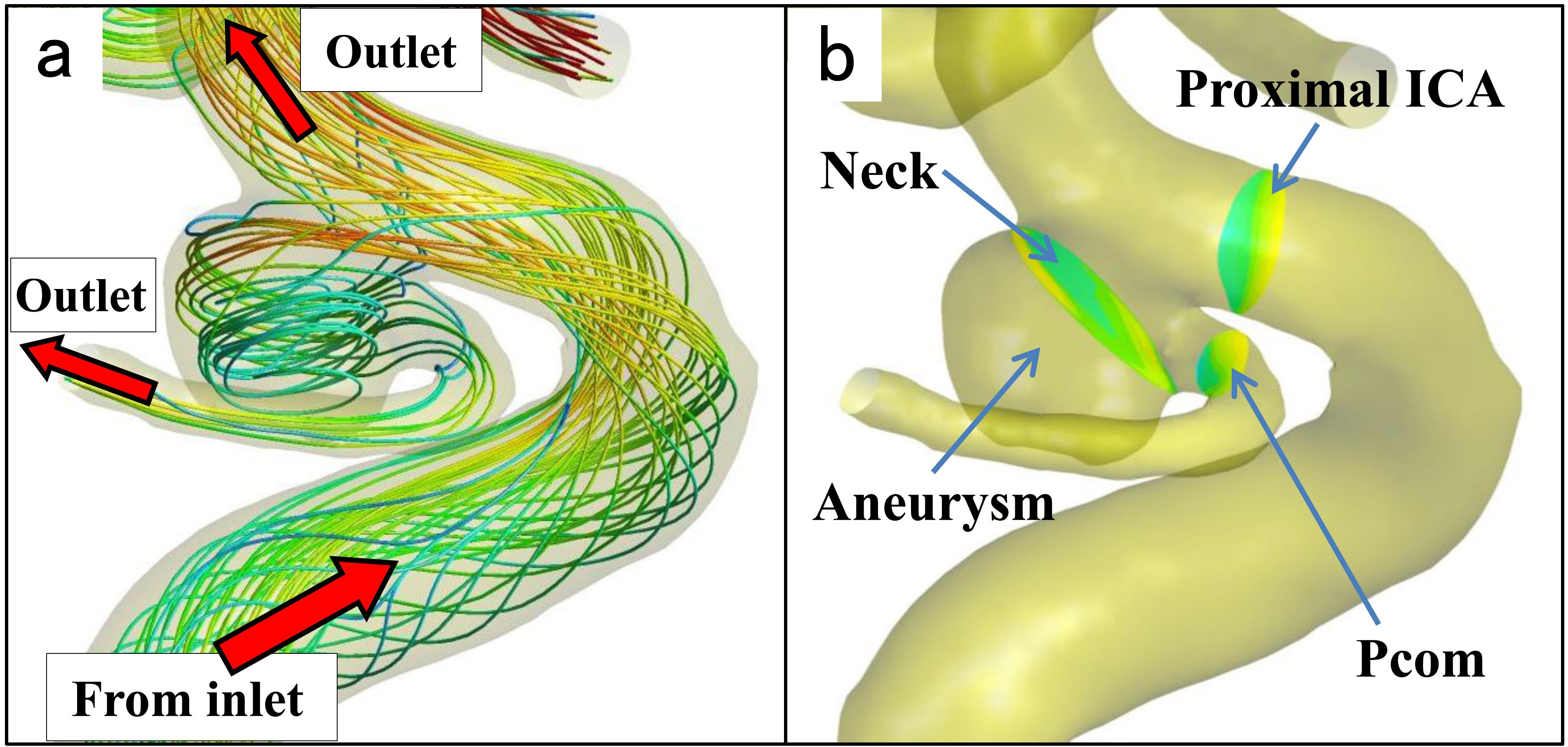 Definition of vascular model. (a): The vascular and aneurysm model with streamlines showing a spatial relationship between inlet and outlets. The streamlines from the inlet, at the proximal site of the internal carotid artery (ICA), run to both the aneurysm and distal site of the ICA, which finally flow into outlet vessels, including the posterior communicating artery (Pcom). (b): The neck plane is defined as just distal to the Pcom bifurcation. The proximal ICA and Pcom planes are defined as 1 mm from the aneurysm.