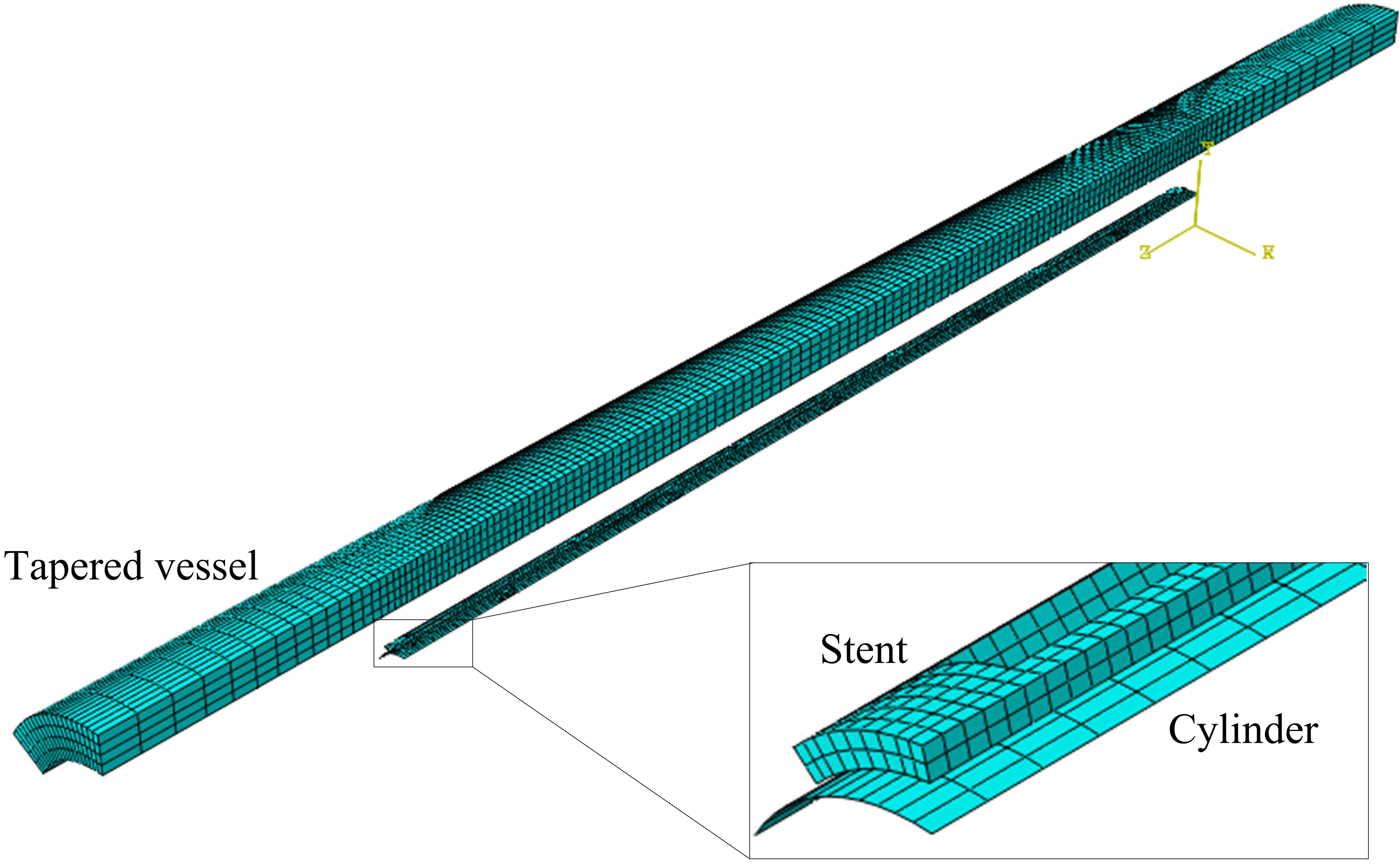 Finite element models of a stent deployment in a tapered vessel.