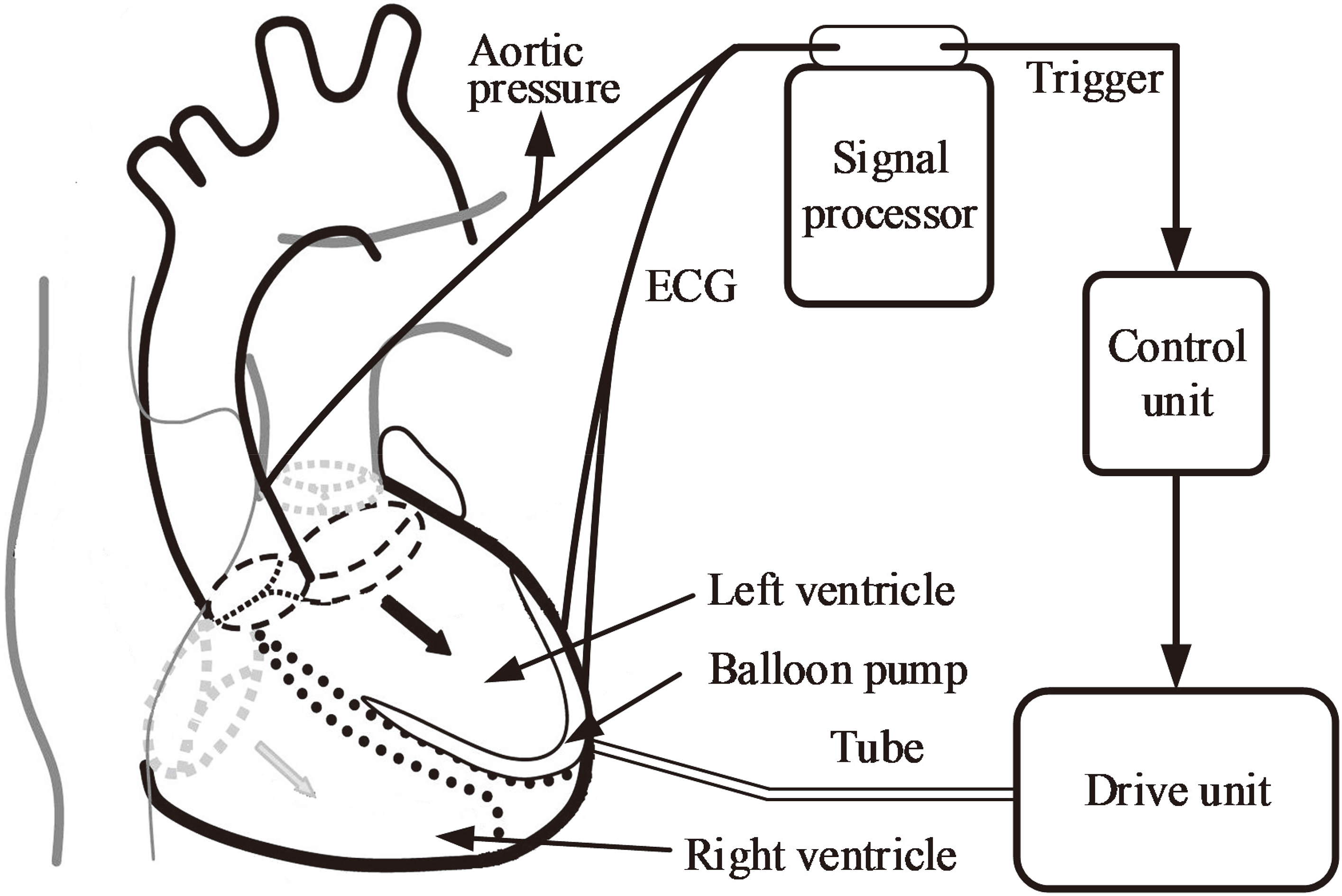 Schematic of a typical intra-ventricular assist device.