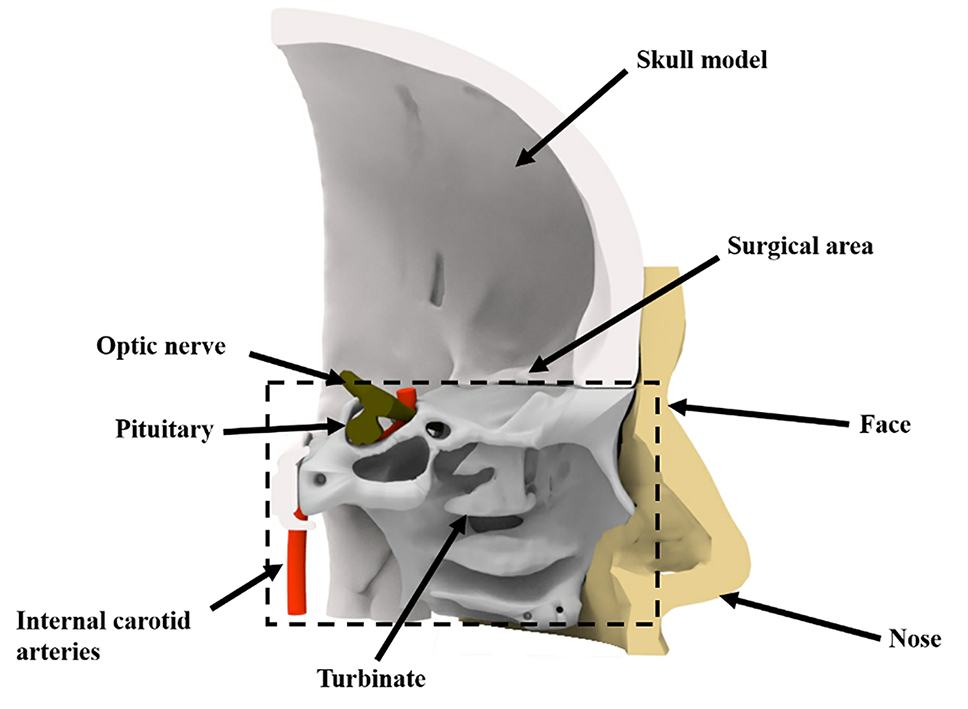 Cutaway view of the digital model. (The surgical area contains the nasal cavity and the sellar region.)