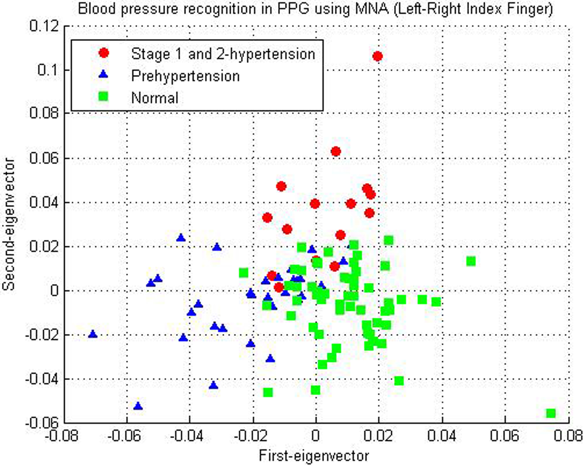 Result of classifying BP into three categories (normotensive, prehypertensive, and hypertensive) using PPG.
