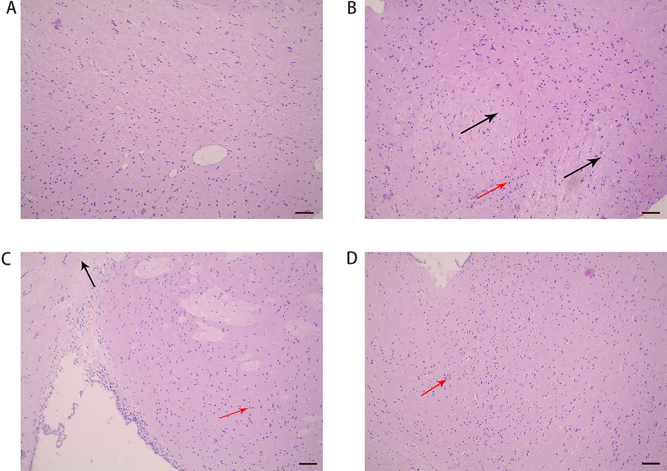 Hippocampus histomorphology of the groups: control (A), model (B), WTKYR (C), and fluoxetine group (D). It was noted that hippocampus histomorphology of the control group was normal. Moderate pyramidal cell edema and infiltration of inflammatory cells were observed in the model group. There was lighter cell edema and inflammation in the rats’ hippocampus tissue of the fluoxetine and WTKYR groups. The black arrows in Fig. 4 point to the cell edema, and the red point to the inflammatory cell infiltration. Bar = 100 μm.