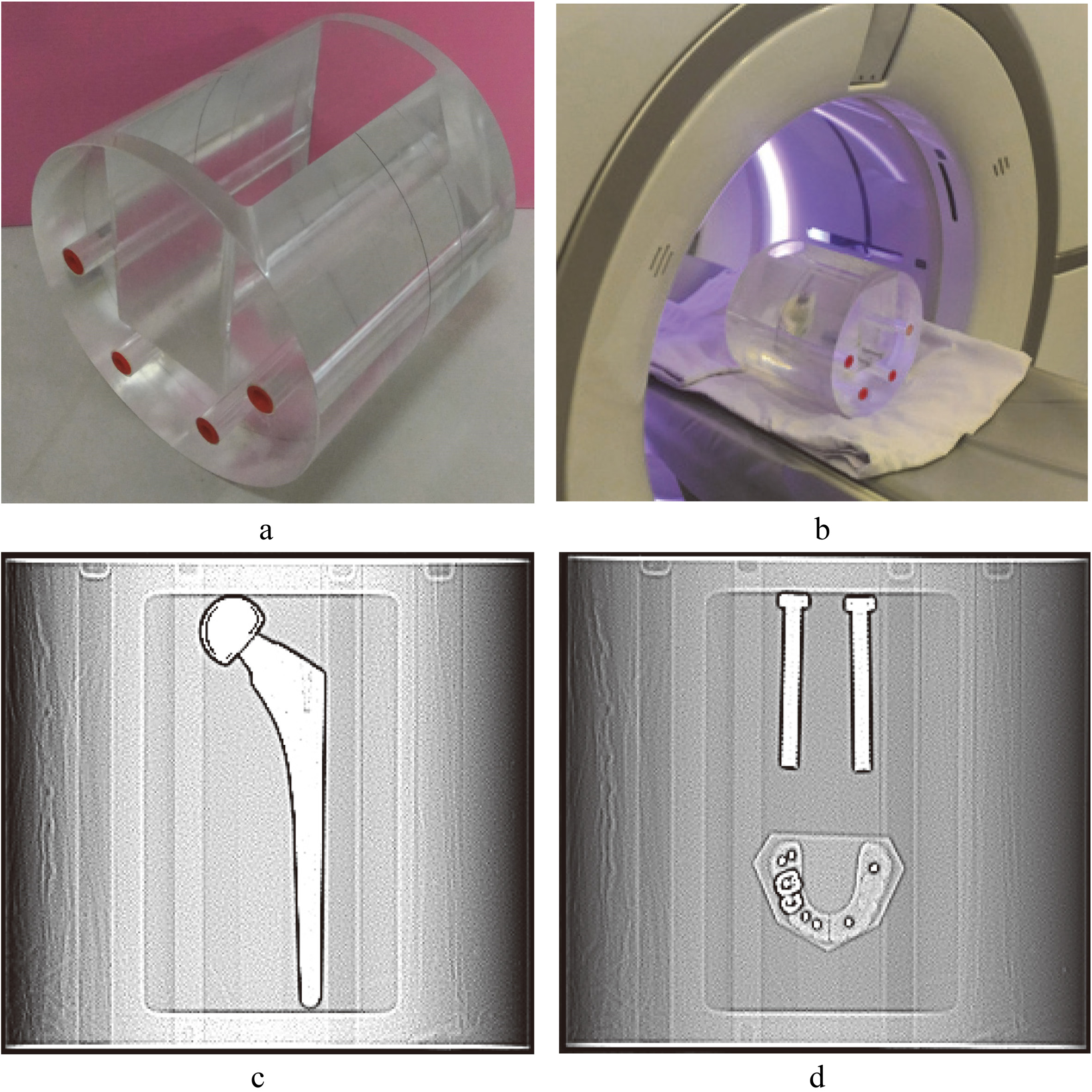 Customized acrylic phantom and scanned images. a. A cylindrical phantom with a rectangular groove in the side of the phantom. b. The phantom with metal implant is placed on the platform of a CT scanner. c. Scout image of hip implant. d. Scout image of spinal implant and dental filling.