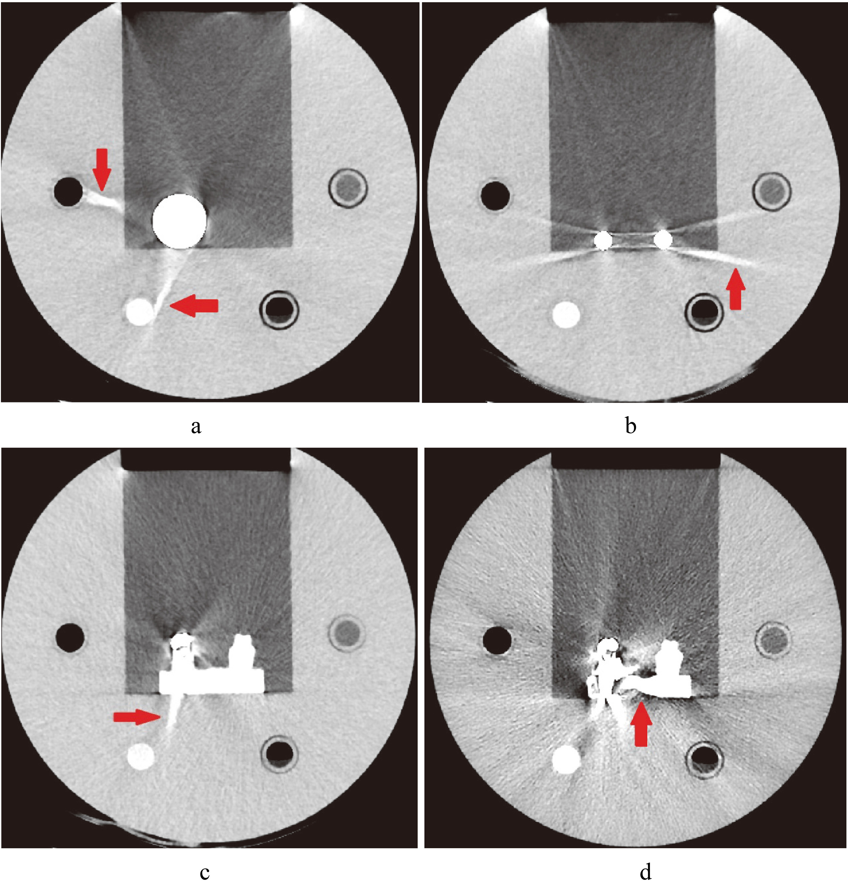 Images of artifacts caused by MAR. a. Image of hip implant with artifact caused by Smart-MAR (red arrow). b. Image of spinal implant with artifact caused by Smart-MAR (red arrow). c. Image of dental filling with artifact caused by Smart-MAR (red arrow). d. Image of dental filling with artifact caused by IMAR (red arrow).
