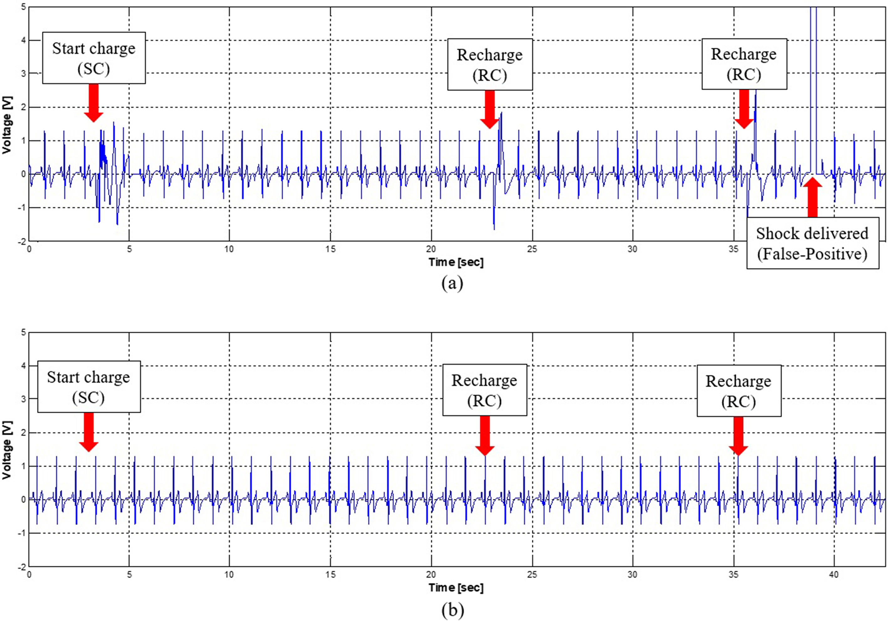 Comparison of the ECG signal before and after application of the isolation barrier. a. Before the proposed method, False-Positive case occurred, b. Electrical noise was not induced and the diagnosis algorithm was operating normally.