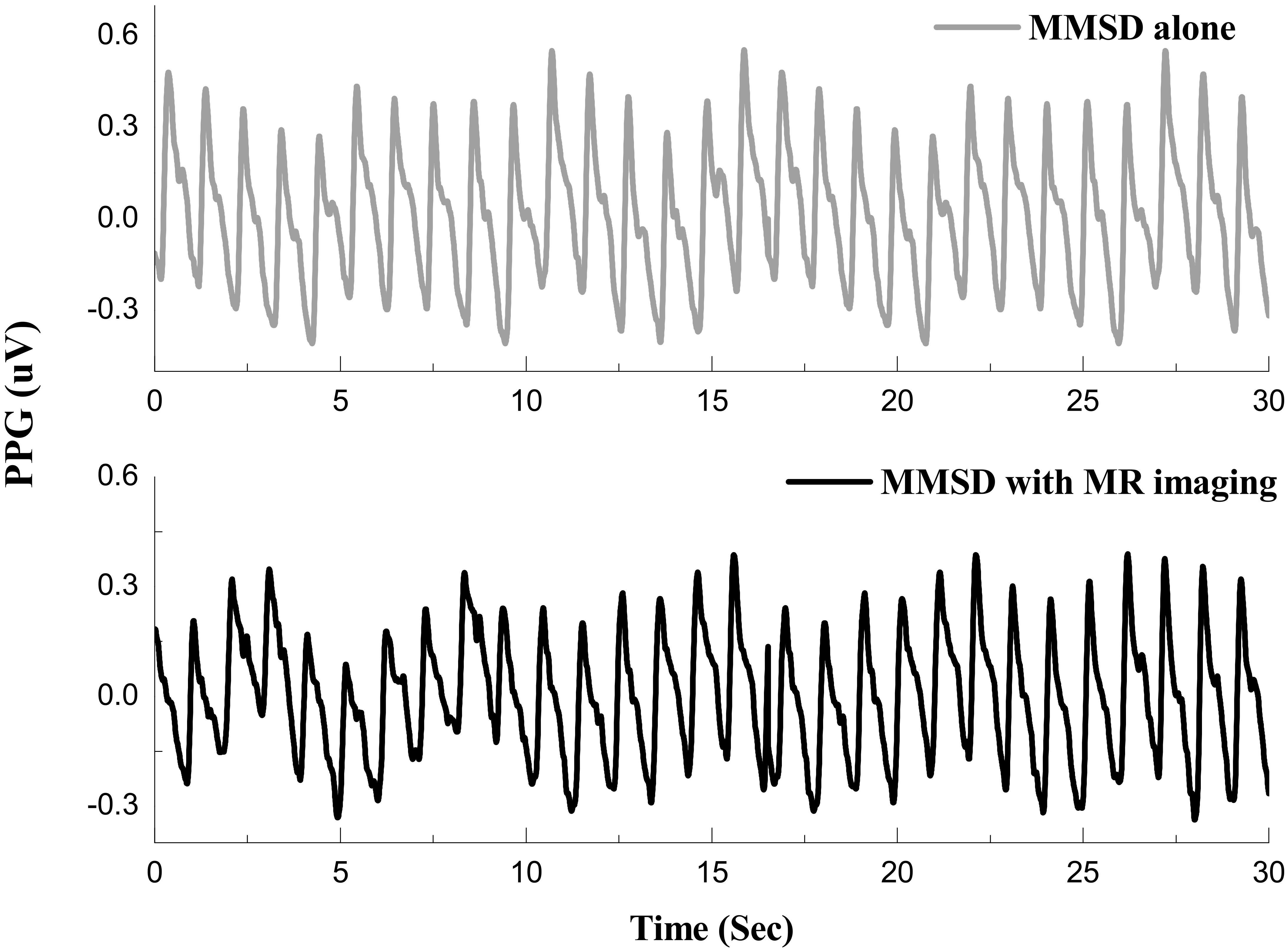 Photoplethysmographic signal in microvolts, measured with MMSD-alone and with MMSD + MR imaging.