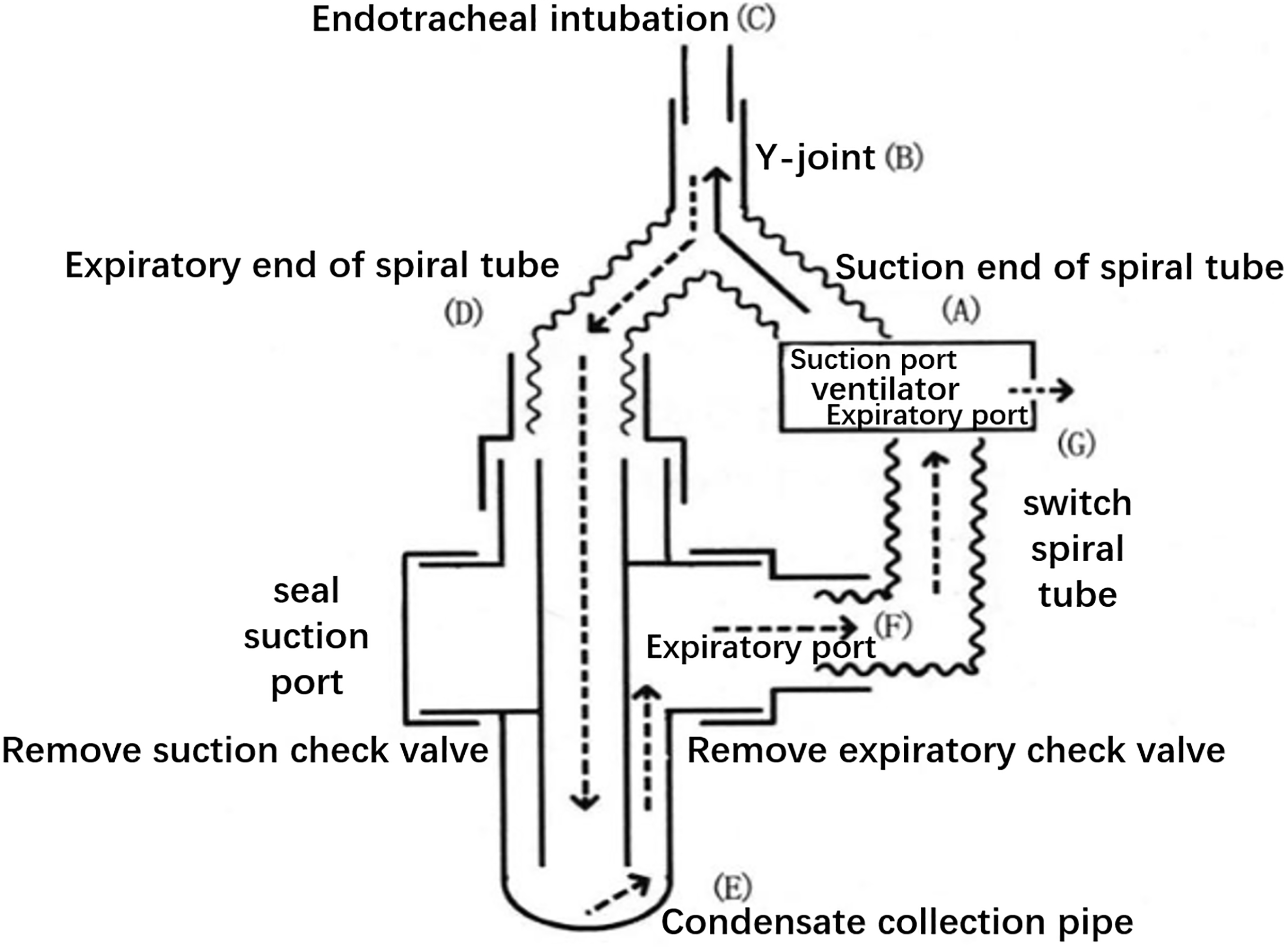 Schematic diagram of the connection between the modified condenser and the ventilator.