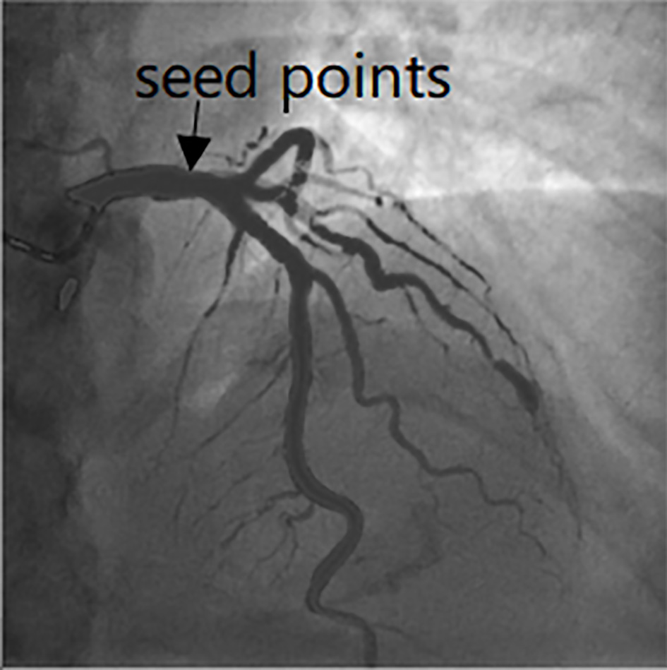 Seed points selection in the image.