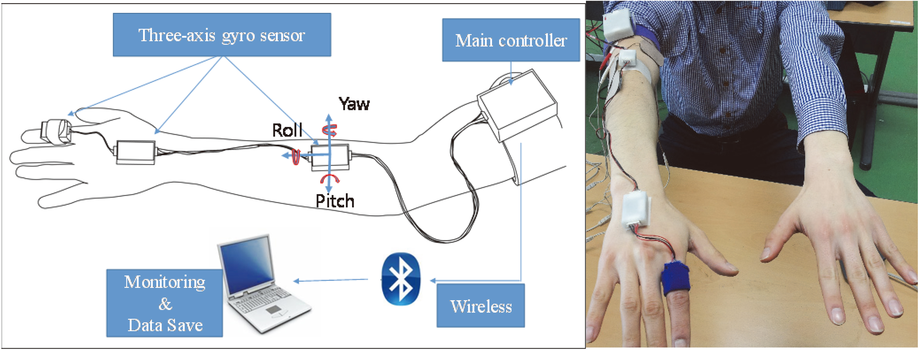 The gyro sensor based wearable device for quantitative measurement of tremors at the fingers, hands and forearm.