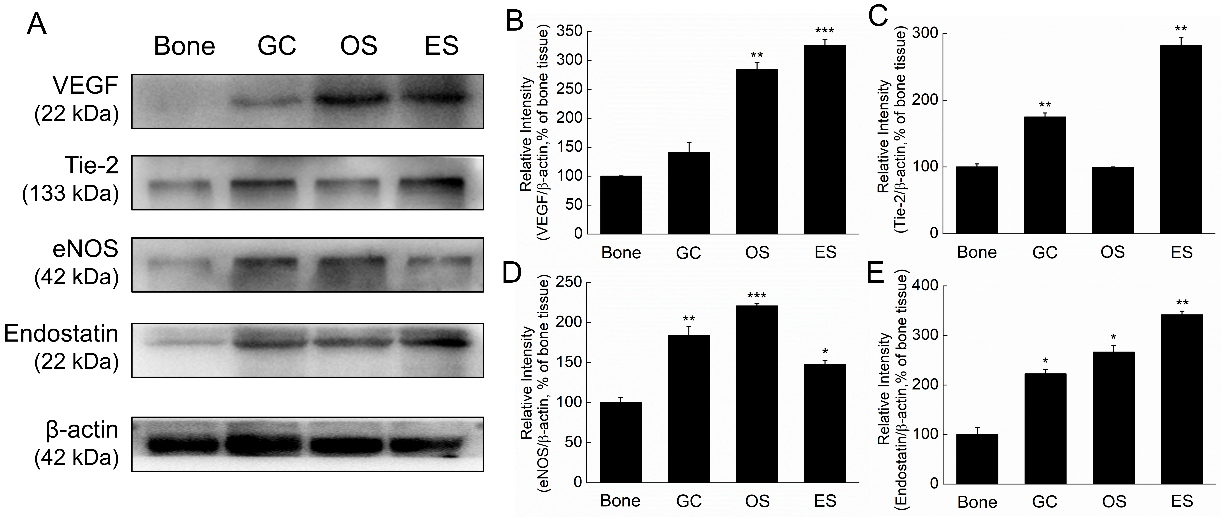 Expression levels of angiogenesis and anti-angiogenesis protein in GC, OS and ES clinical tissues. A. VEGF, Tie-2, eNOS, endostatin and HIF-1α were determined by Western blot analysis. B–F. Quantification of VEGF, Tie-2, eNOS, endostatin and HIF-1α protein expression was performed by densitometric analysis and β-actin was acted as an internal control. The data are shown as the means ± SD, P*< 0.05, P**< 0.01 and P*⁣**< 0.001 versus the normal bone samples.