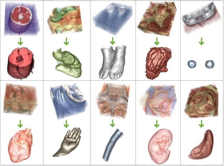 3D human organ models extraction from color volume images. From the upper left to low right (row-major order), the images show respectively extraction experiments for the thigh muscles model (by 10 matting components), large intestine model (by 14 matting components), feet model (by 9 matting components), stomach model (by 15 matting components), eyes model (14 matting components), heart model (by 17 matting components), hand model (by 10 matting components), medulla spinalis model (by 8 matting components), kidney model (by 19 matting components) and spleen model (by 16 matting components).
