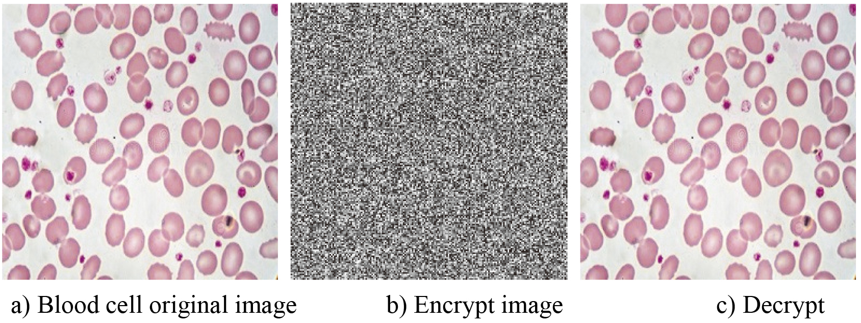Encryption effect of blood cell image.