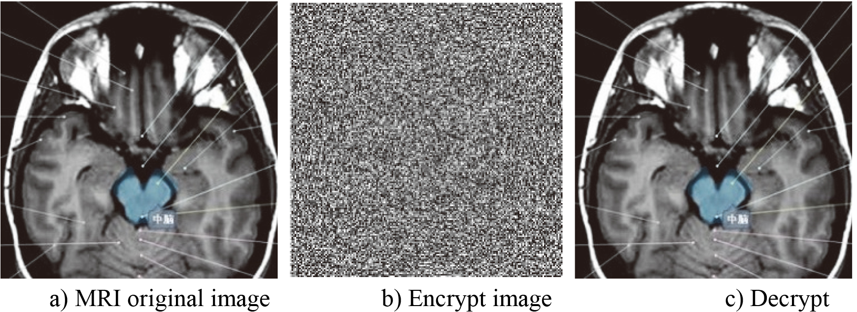 Encryption effect of MRI image.