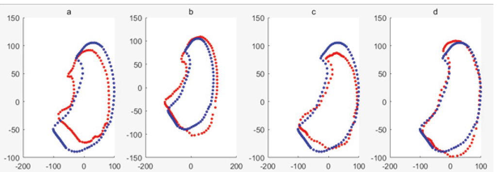 Mean shape of training sample set including noise samples is shown in blue, the deformed shape based on RPCA of ASM is shown in red, when t=1∼4 respectively. The shape model is shown in Fig. 9 using ASM of PCA for the training data set with noise samples. The code of traditional ASM was used [7].