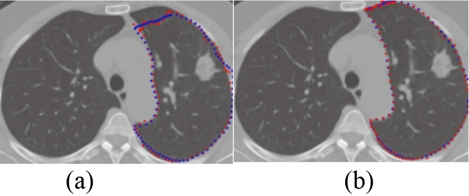 The result of lung segmentation. (a) [15]’s method (b) ASM based on RPCA.