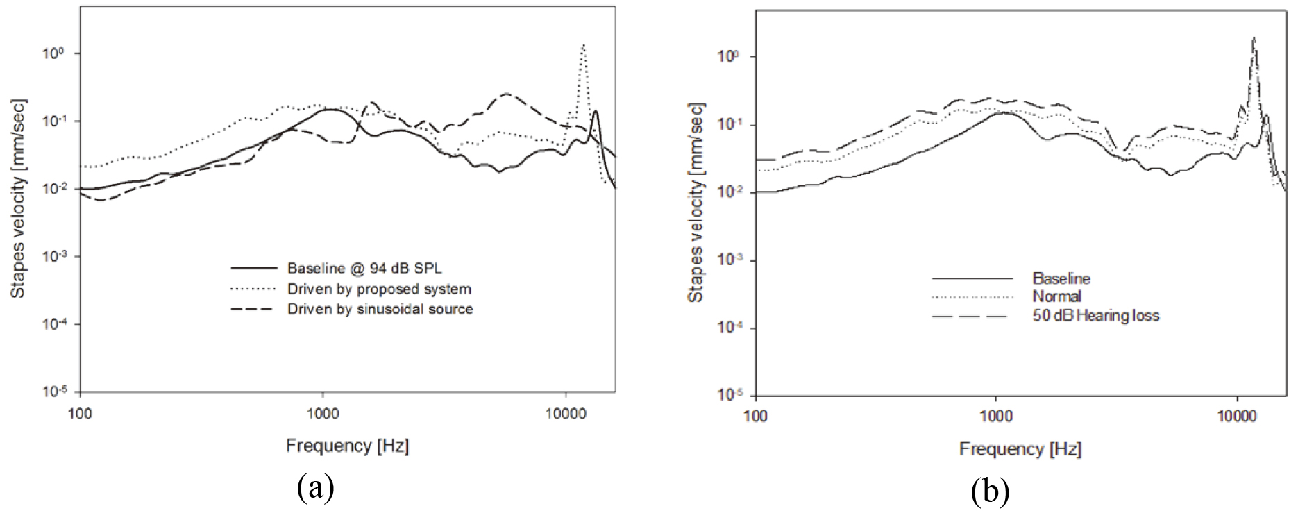 Results of human cadaver experiments; (a) basic output characteristic with no gain, (b) comparison of gain characteristic for normal hearing loss and 50 dB hearing loss by FIG6 fitting rule.