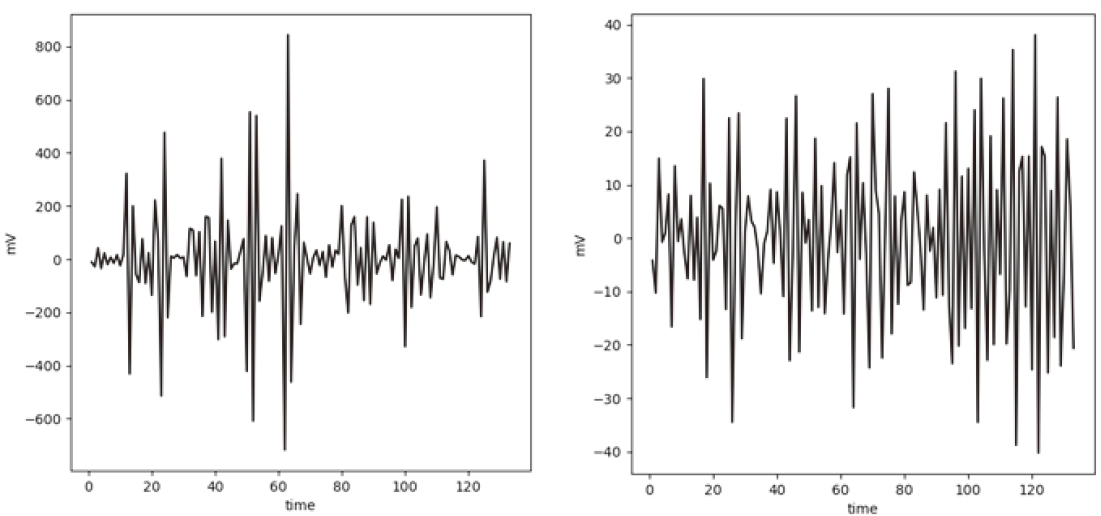 Examples of wavelet transformed epileptic seizure (left) and normal (right) EEG signal.