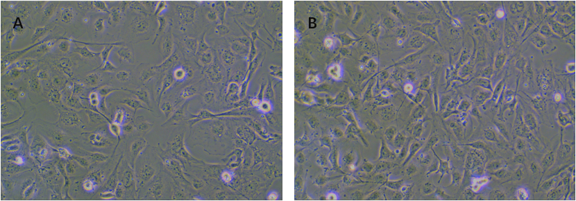 The morphology shape of HUVECs (A) the morphology of HUVECs in control group (B) the morphology of HUVECs in hydroxyapatite bioceramic extract treatment group.