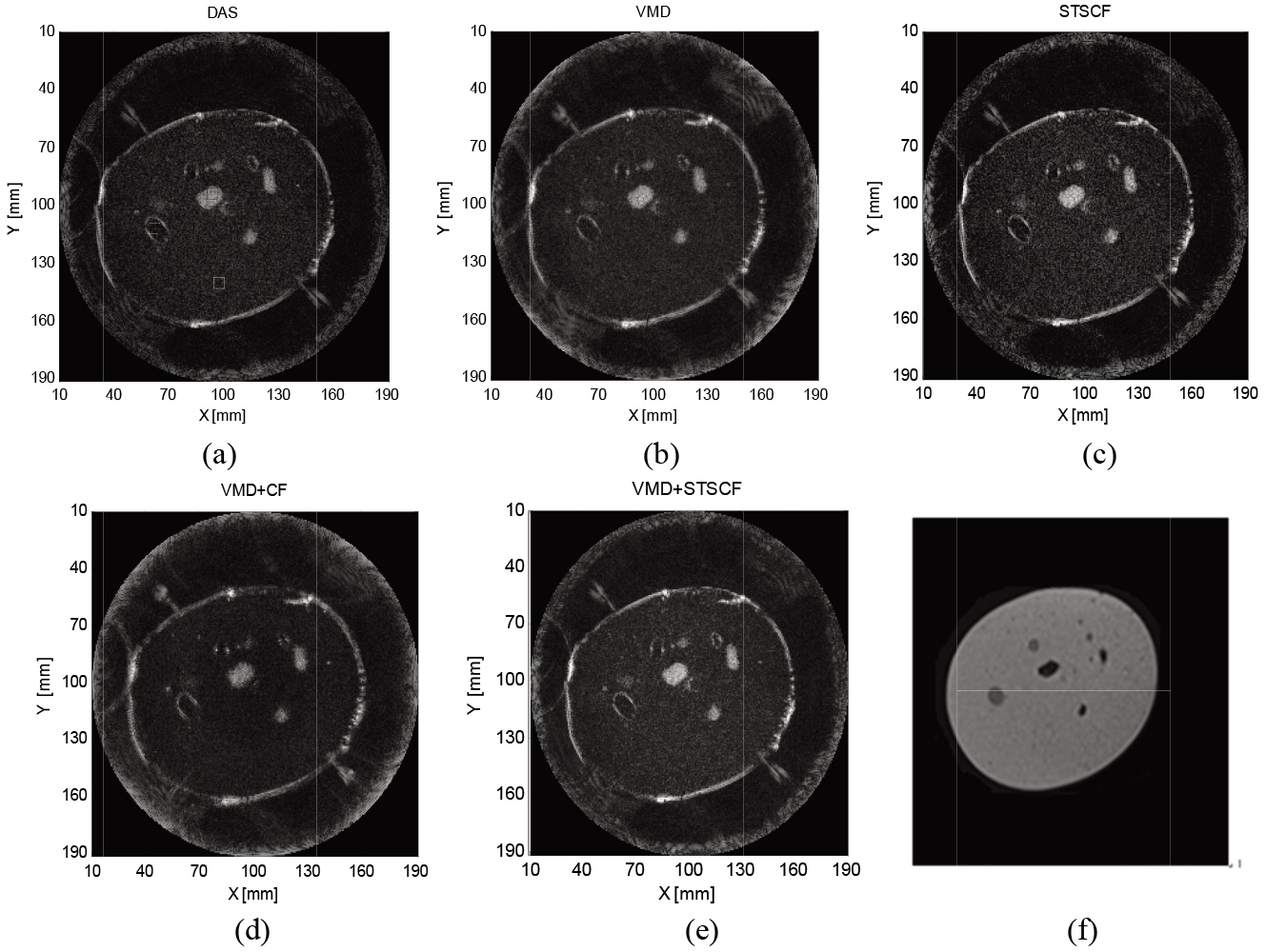 Reconstructed images of breast phantom by (a) DAS; (b) VMD; (c) STSCF; (d) VMD+CF; (e) VMD+STSCF; (f) MRI.