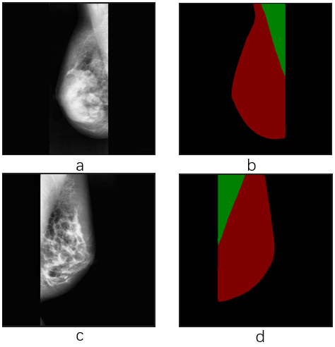 Effect of semantic segmentation. Image a and c are input images with different orientations. Image b and d are output labels with breast region extraction as the red part, as well as pectoral muscle region part as the green part.