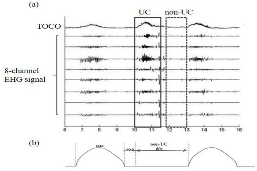 (a) Illustration of the TOCO signal and eight EHG signals (b) The duration reference used to segment the EHG signal.