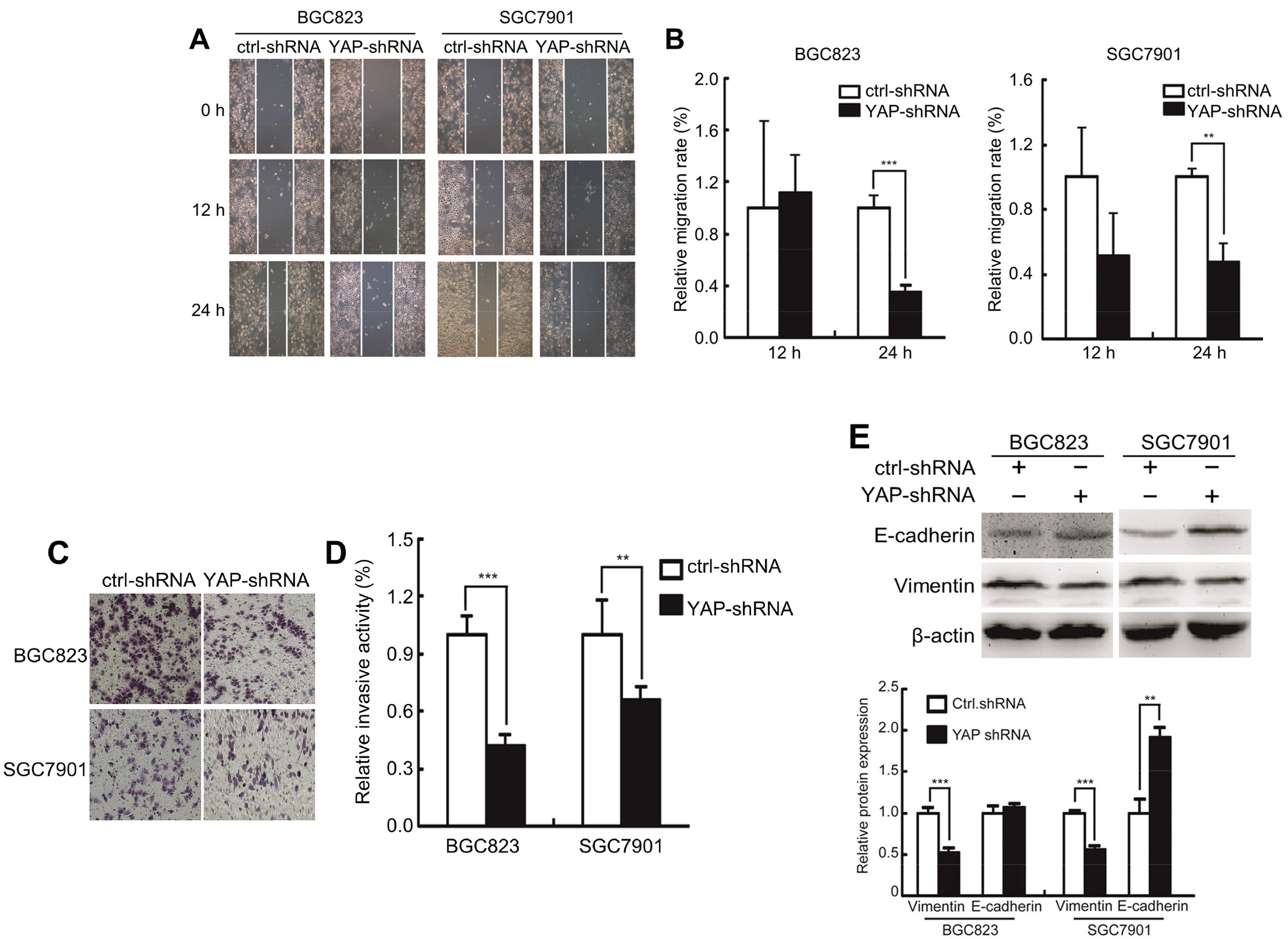 YAP1 enhances the metastatic capacity of GC cells in vitro. (A) Migration capabilities of SGC7901 and BGC823 cells assessed by scratch wound assay. (B) Relative migration rate of SGC7901 and BGC823 cells assessed by scratch wound assay. (C) Invasion assay of SGC7901 and BGC823 cells transfected with shRNA control and YAP-shRNA. (D) Relative invasion activity of SGC7901 and BGC823 cells transfected with shRNA control and YAP-shRNA. (E) Expression of E-cadherin and vimentin of SGC7901 and BGC823 cells transfected with shRNA control and YAP-shRNA detected by Western blot. P*< 0.05, P**< 0.01, P*⁣**< 0.001. 