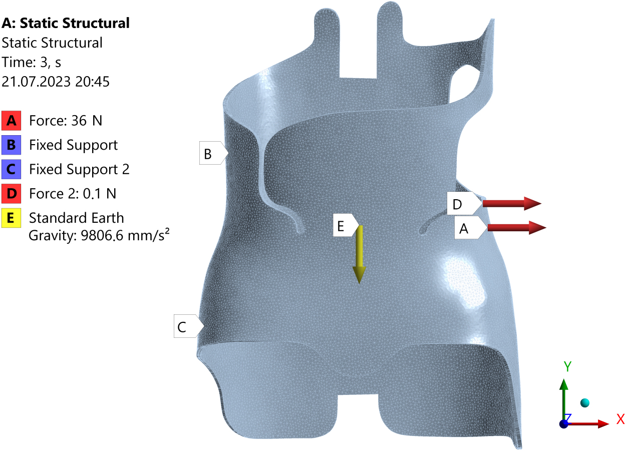 Diagram of the Boston brace in frontal view-depicting the simplified correction mechanism for the left lumbar curve. Forces exerted by the brace: B and C – supporting forces, A – primary corrective force, D – extra load introduced following the pre-stressing of the brace with force, A, E – standard earth gravity.