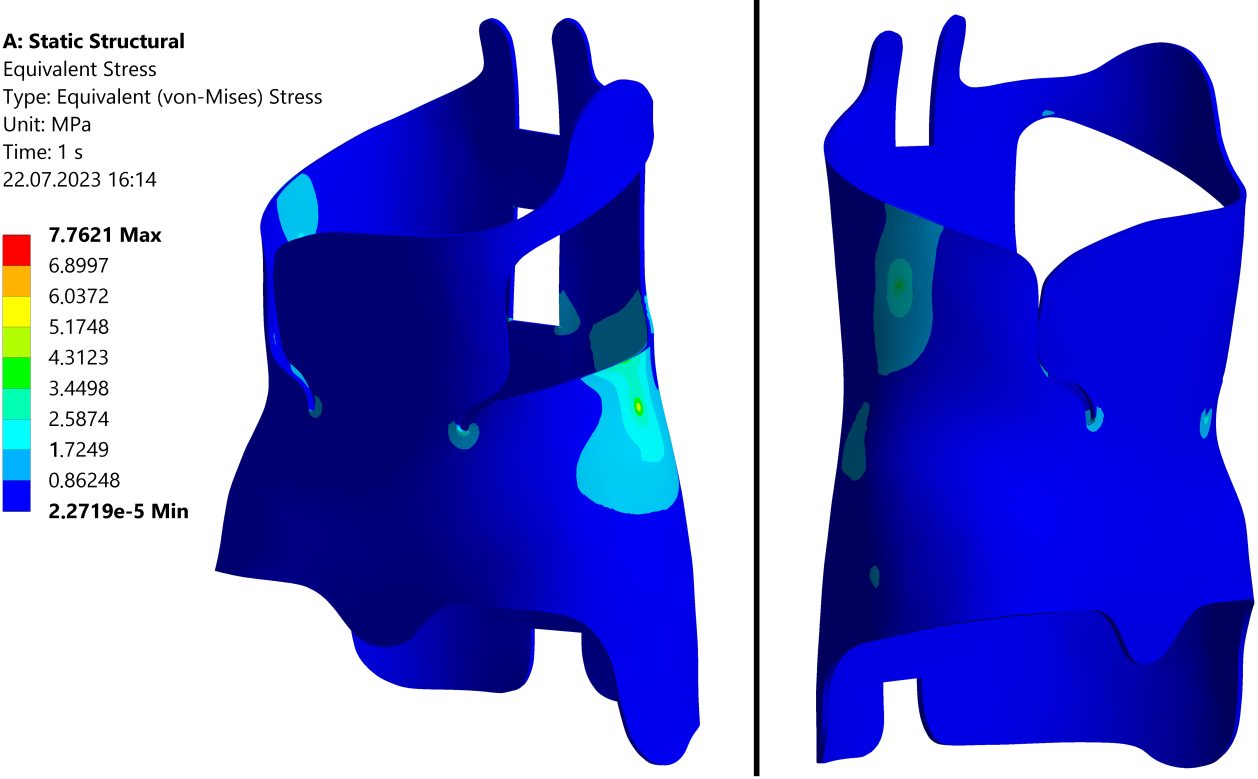 View of original brace with equivalent values of von Mises stress.