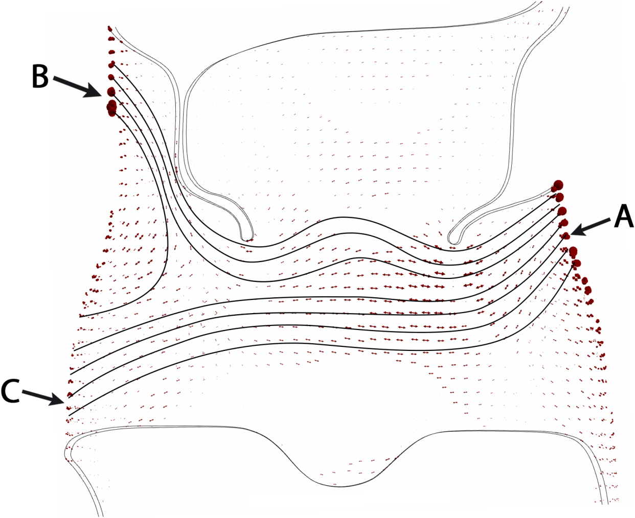 Distribution of the principal tensile stress vectors σ1 with trajectories of principal stress drawn on the original brace. Points of application of forces: force C exerted to the pelvis and forces A and B exerted on the thoracic region.