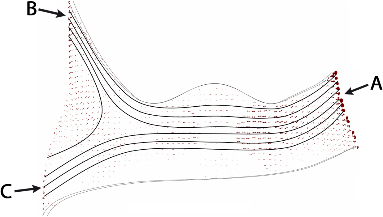 Distribution of the principal tensile stress vector σ1 with trajectories of principal stress drawn on the modified brace. Points of application of forces: force C exerted to the pelvis and forces A and B exerted on the thoracic region.