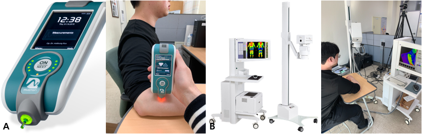 Measurement of muscle biomechanical properties using MyotonPro.