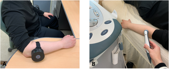 Intervention program. A: Low-intensity wearable ultrasound B: Chattanooga group – Intellect Transport Ultrasound.