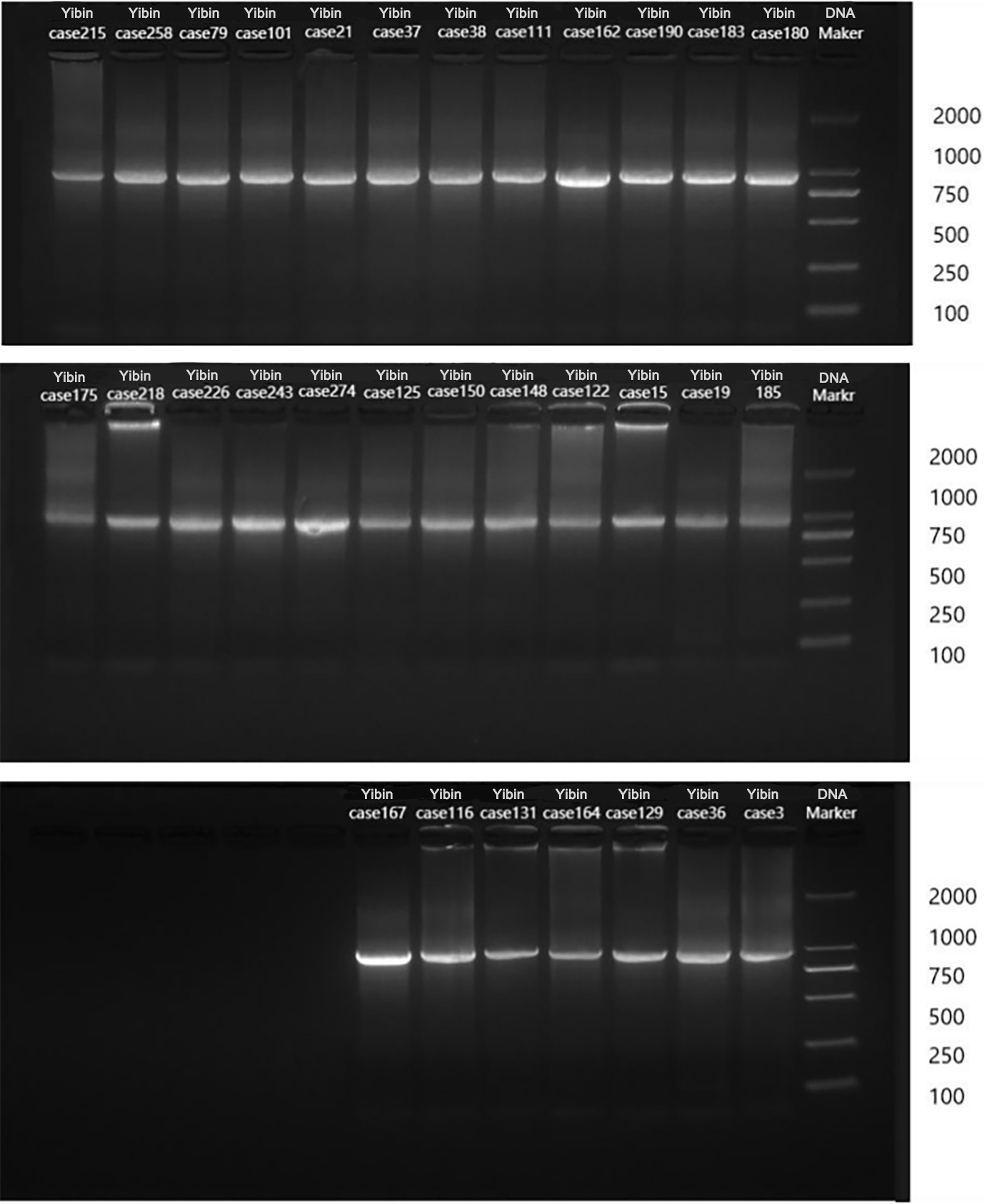 Agarose gel electrophoresis of PCR amplified products of 31 samples of adenovirus hexon genes.