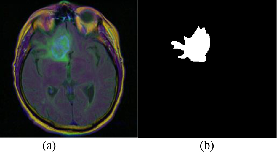 Details of dataset. (a) Brain MRI image. (b) Manual Segmentation mask.