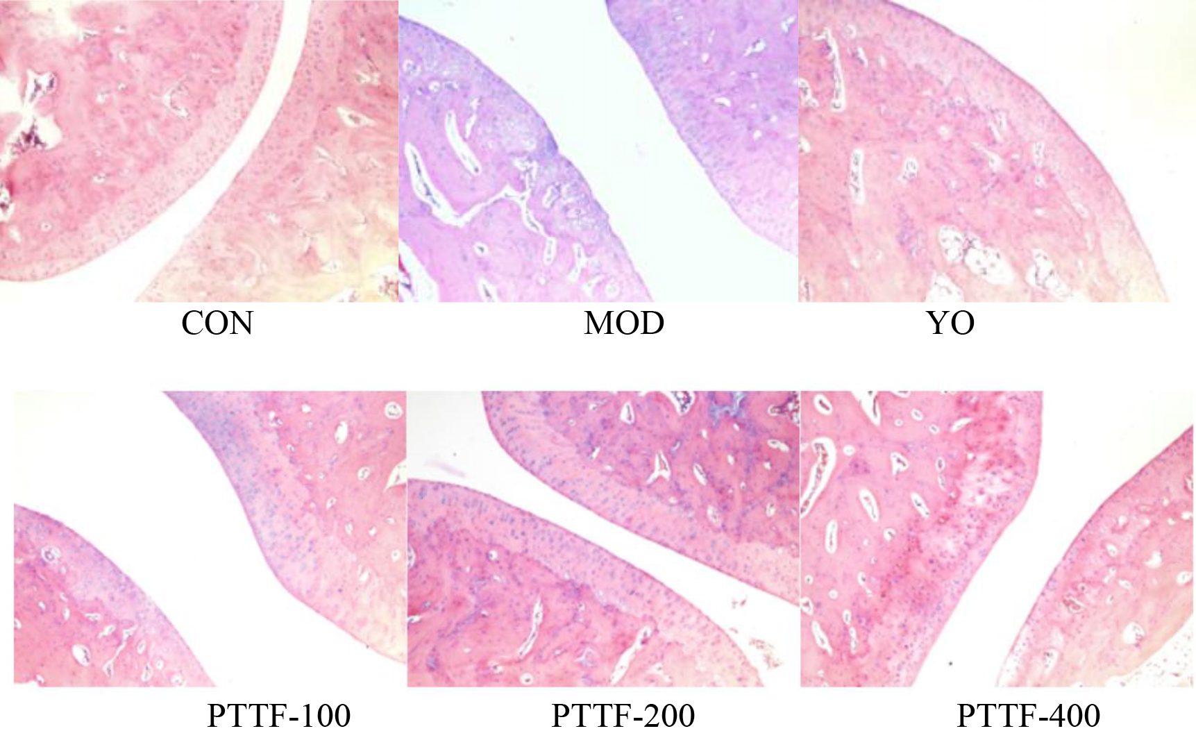 The effects of PTTF on the pathological morphological changes of ankle joint tissues in gouty arthritis rats (× 200). Note: A: CON; B: MOD; C: YO; D: PTTF-L; E: PTTF-M; F: PTTF-H; CON: Blank group; MOD: Model group; YO: Colchicine group; PTTF-100: Prunus Tomentosa Total Flavones 100 mg/kg-Dose group; PTTF-200: Prunus Tomentosa Total Flavones 200 mg/kg-Dose group; PTTF-400: Prunus Tomentosa Total Flavones 400 mg/kg-Dose group.