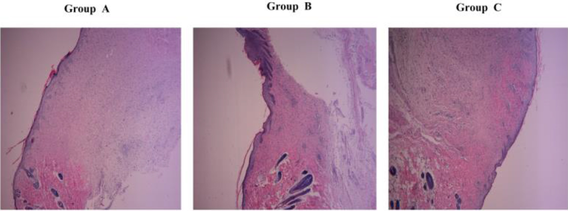 Differences in HE staining of fibrous tissue within the healed wound on the 15th day.Group A is the normal control group, Group B is the EGF group, and Group C is ELF-EMF+EGF group.