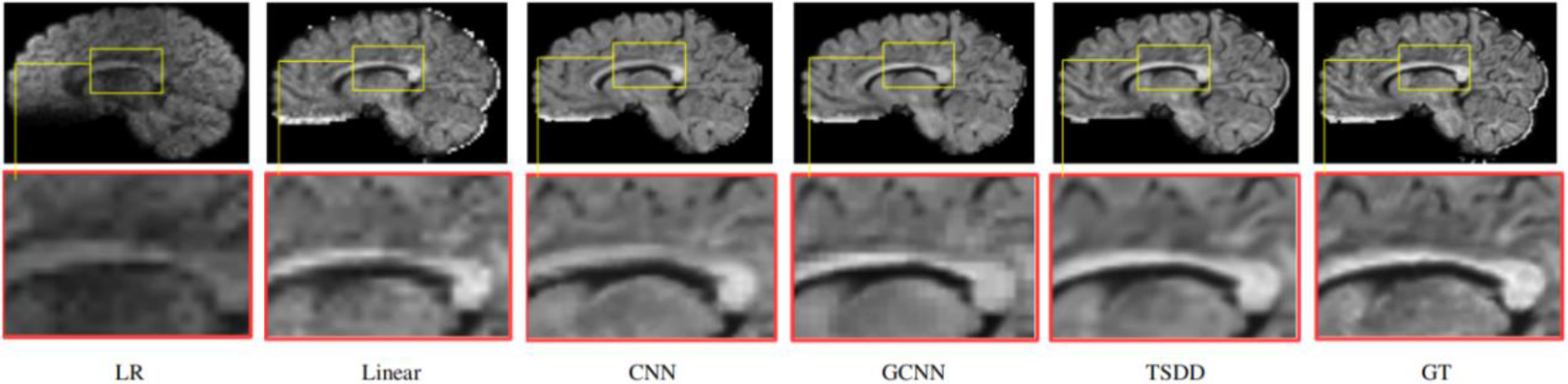 Detailed comparison of the reconstructed DWI scans.