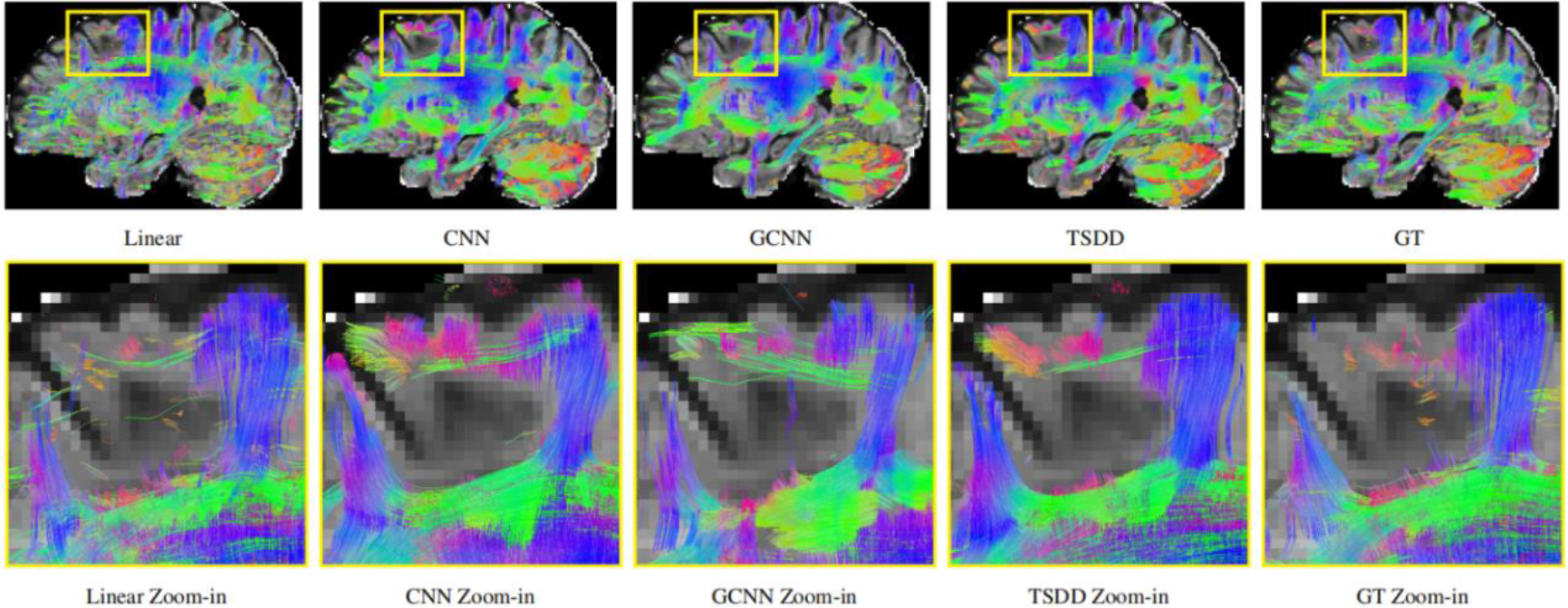 Comparison of fiber tractography using different models.