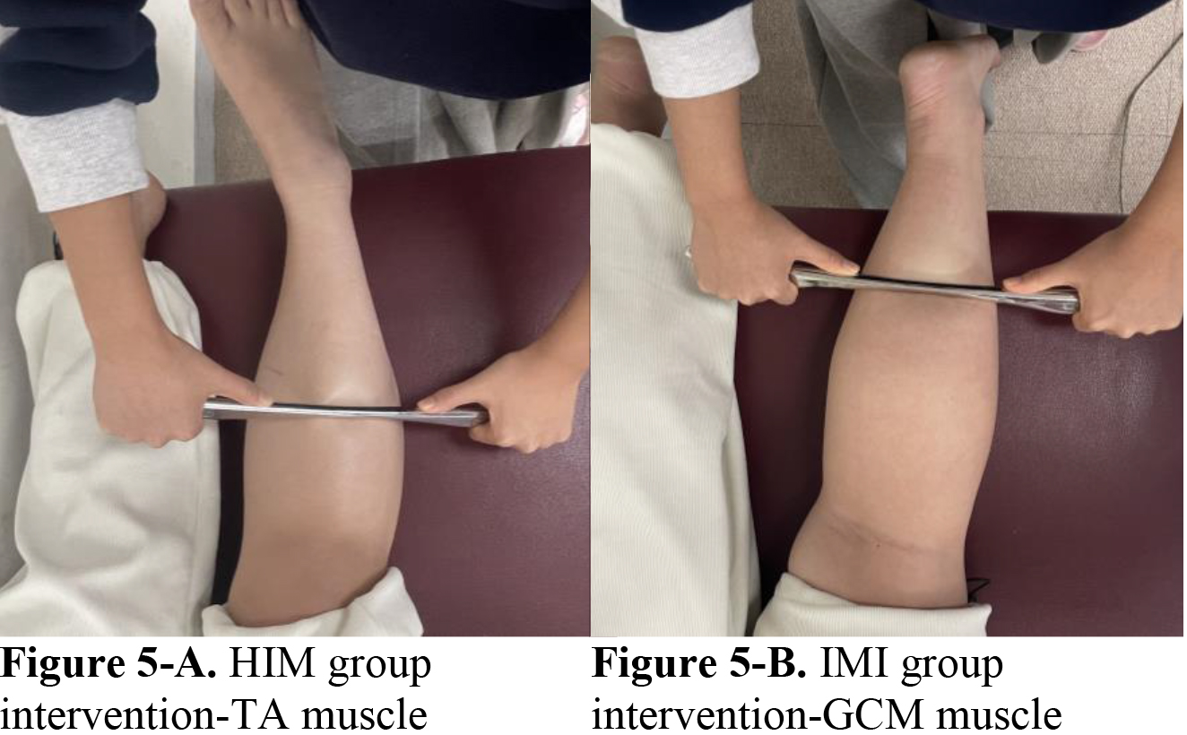 The lateral and medial GCM muscles were mobilized with the instrument assisted mobilization in the IMI group. The instrument assisted mobilization of the TA muscle was initially performed on the HIM group. And then the GCM muscles, both medial and lateral, are used.