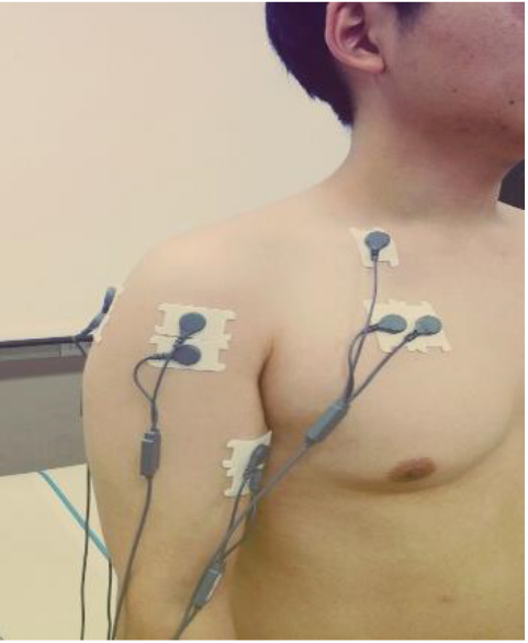 Surface EMG device attached to the body (front).