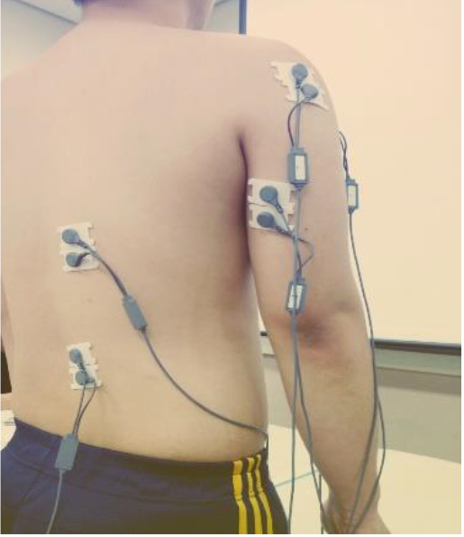 Surface EMG device attached to the body (back).