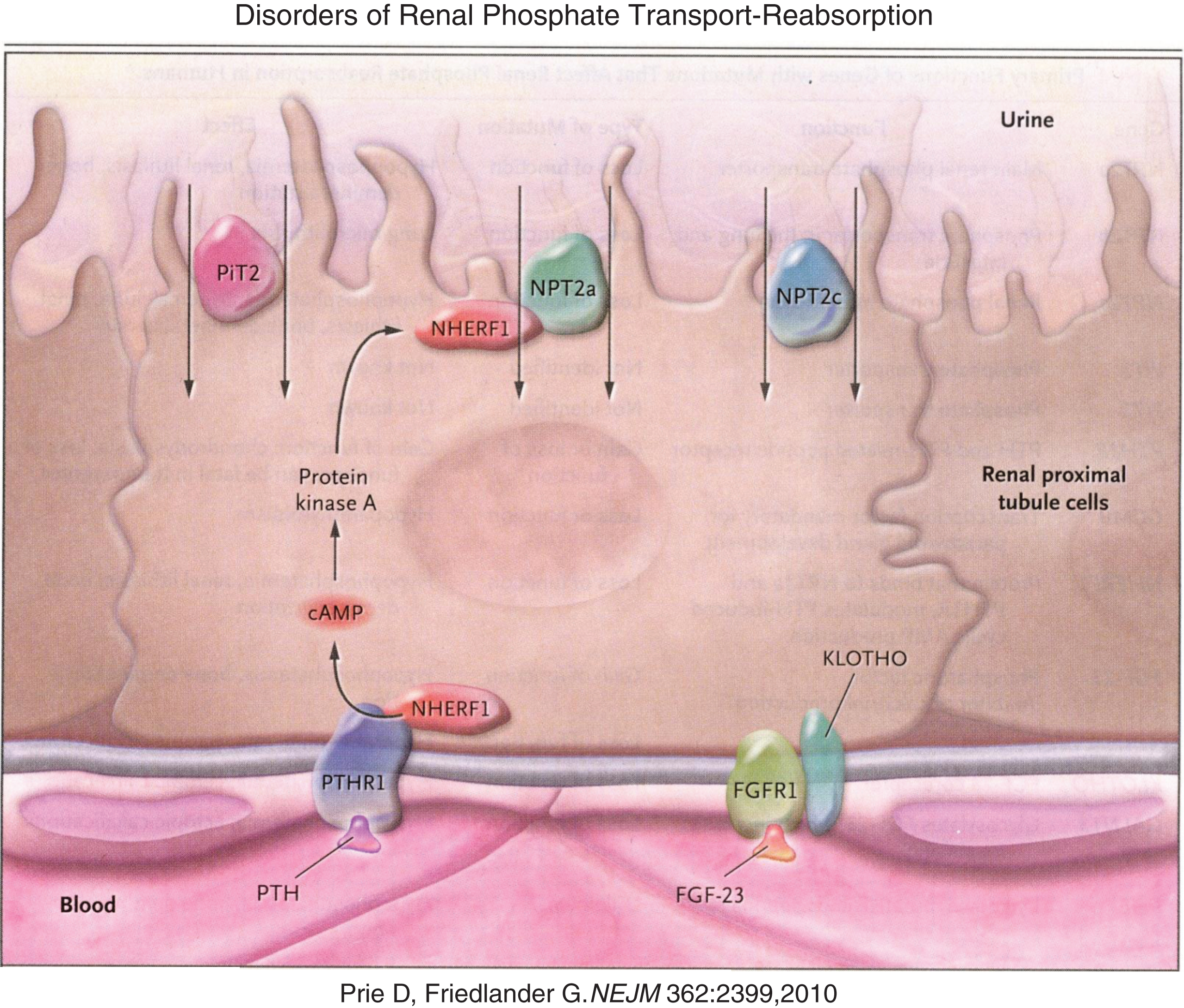 Reabsorption of phosphate from the renal tubule is blocked by PTH and FGF23 acting upon their respective receptors to down regulate the number of sodium phosphate luminal transmembrane channels through which phosphate is reabsorbed from the glomerular filtrate. (Reproduced with permission from Prie D, Friedlander G. Genetic disorders of renal phosphate transport. N Engl J Med 362:2399-2409,2010.)