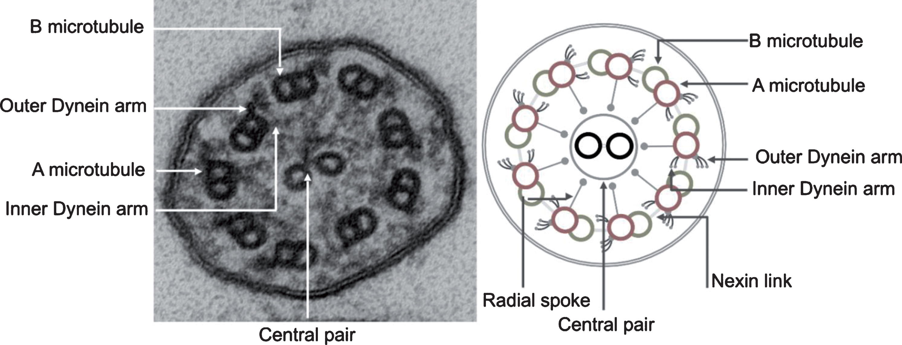 Transmission electron photomicrograph (left) and schematic diagram (right) of a normal motor cilium in cross-section showing the ultrastructural features of the ciliary axoneme.