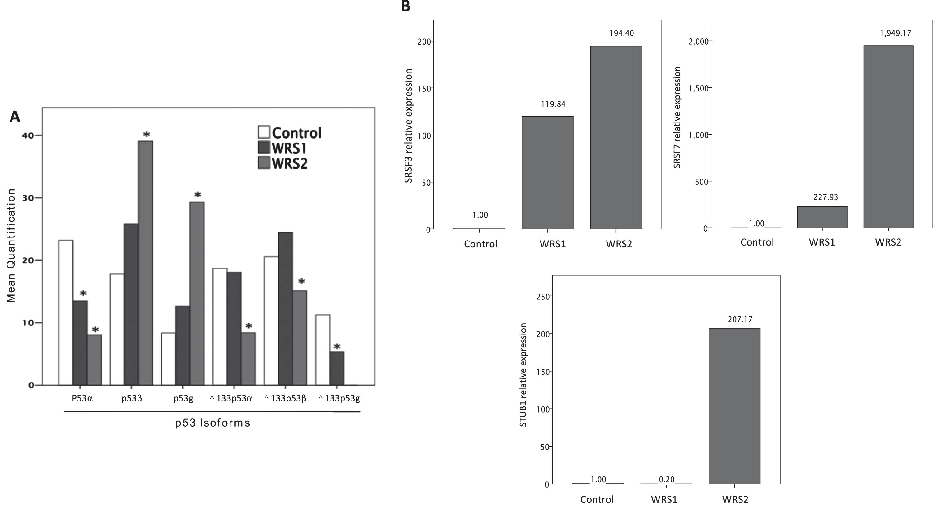 Relative expression of TP53 isoforms measured by agarose electrophoresis of nested PCR products and mRNA relative expression of SRSF3, SRSF7 and STUB1; involved in p53b and D133p53a regulation. A) Relative expression of TP53 isoforms (one asterisk (*), p < 0,05) showing and increased expression of p53b and a decreased expression of D133p53a in WRS2 cells. B) mRNA relative expression of SRSF3, SRSF7 and STUB1 normalized to GAPDH expression. WRS cells showed an increased expression of SRSF7 related to a rise in p53b expression, although the expression of STUB1 was markedly augmented in WRS cells, it was not enough to increase the expression of D133p53a.