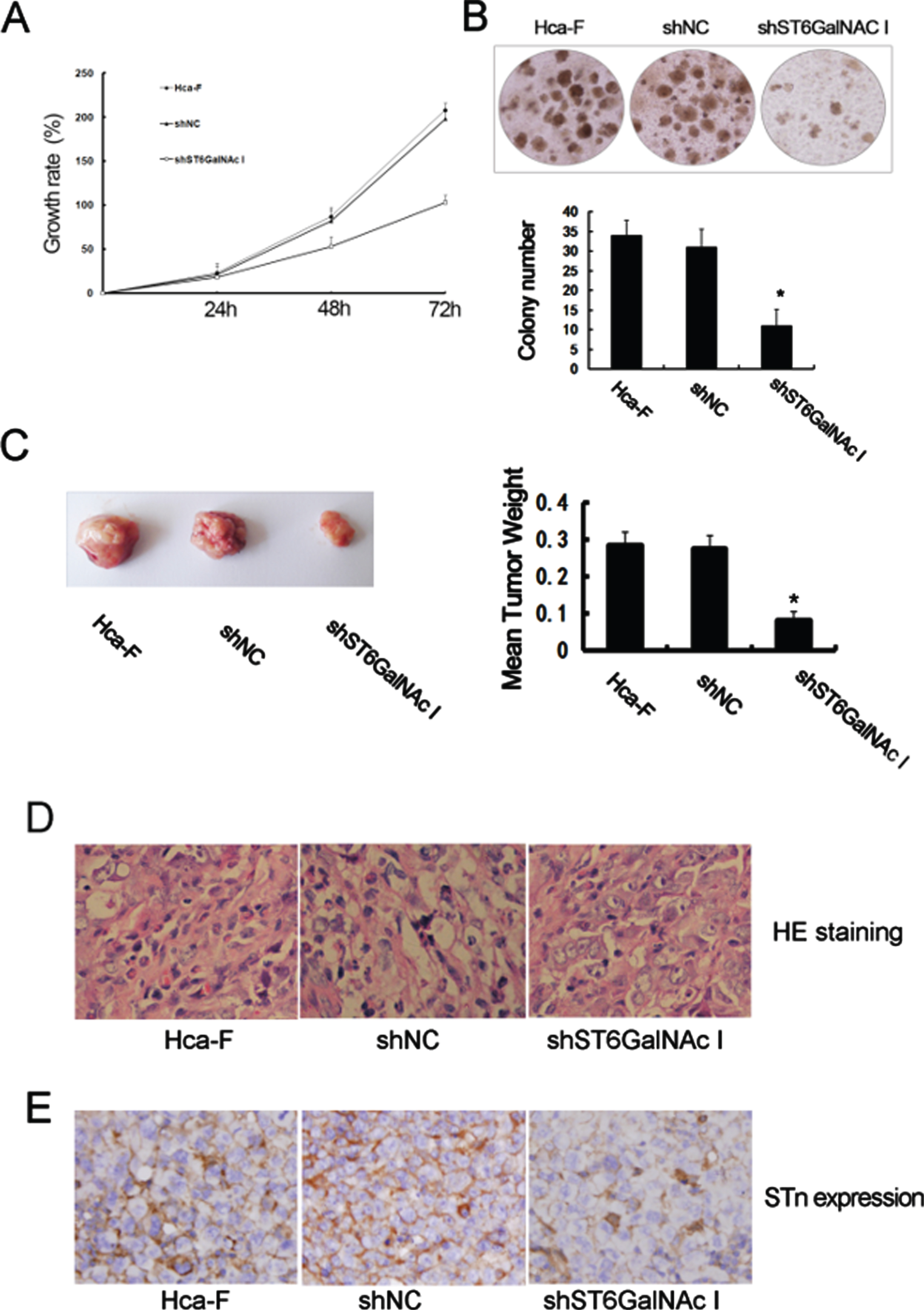 ST6GalNAc I silencing inhibits the proliferation and clonogenicity of Hca-F cells. a Cell proliferation was determined by the CCK8 assay. The numbers of Hca-F, shNC, and shST6GalNAc I cells were counted over a period of 3 days. The results represent mean values from three independent experiments±SD. P <  0.05. b Representative field photograph by colony-forming assay of Hca-F, shNC, and shST6GalNAc I cells (×100). Each value is the mean±standard deviation (SD) of ten different fields (*P <  0.05). c Weight of tumor was compared between Hca-F/shST6GalNAc I and Hca-F cells. Each value is the mean±SD (*P <  0.05). d, e HE staining for tumor tissues and STn expression in tumor tissues were assessed by immunohistochemistry. The data were obtained from three independent experiments.