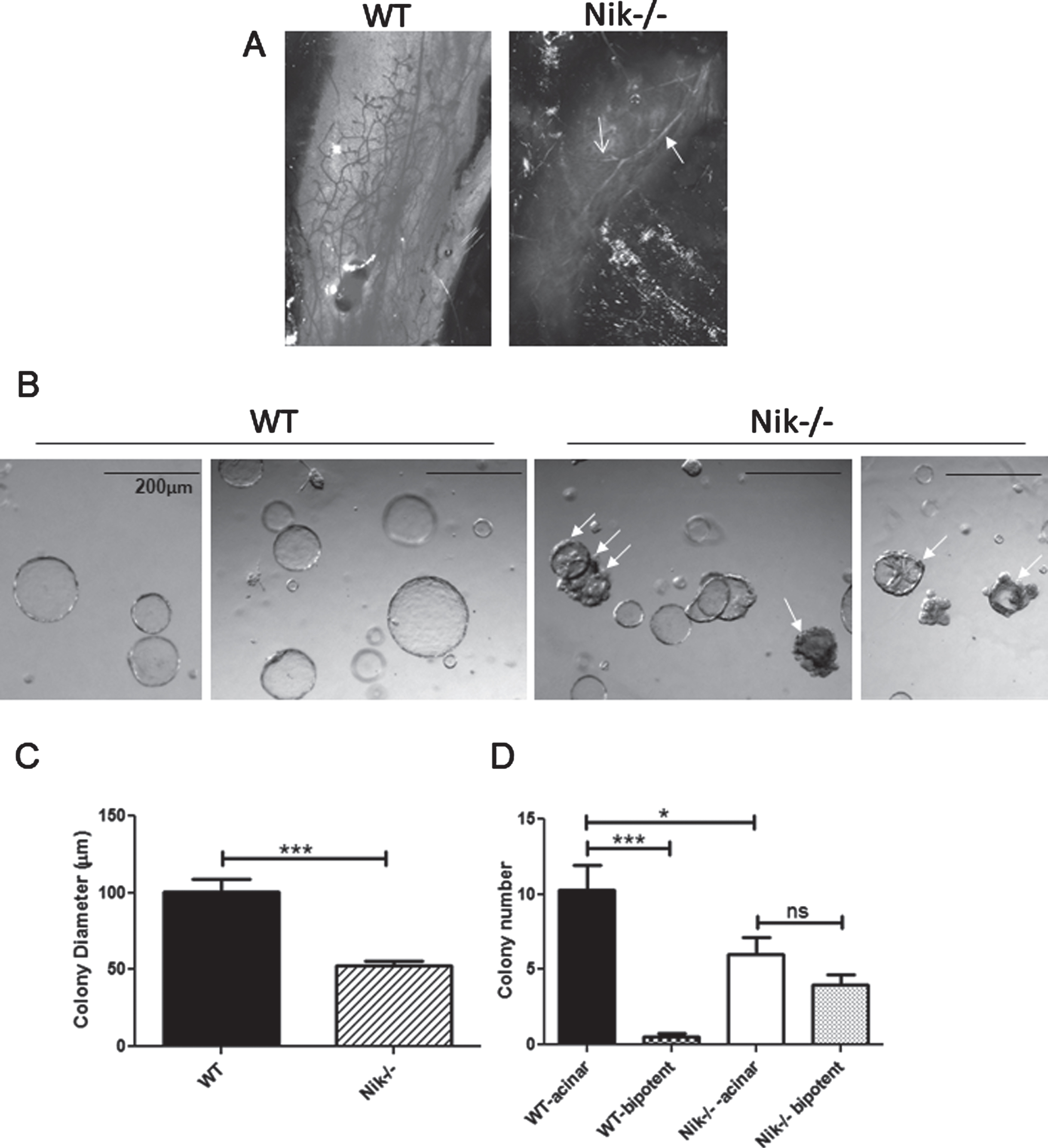 Nik-/- mice have high levels of undifferented bipotent progenitors and poorly differentiated mammary glands: A, Linneg mammary cells from WT and Nik-/- mice were used for Matrigel colony assays. Acinar colonies are luminal and bipotent colonies are partially filled and have uneven cellular borders (arrows). B, Graph showing all colony diameters (mean +/- SEM) from WT and Nik-/- colony assays derived from 3 separate experiments. C, Graph depicting luminal and bipotent colonies from mice as indicated. ***p < 0.0001; *p < 0.05; ns-not significant (One-way ANOVA). D, Images of whole mammary glands from 6 week old virgin WT and Nik-/- mice. Solid arrow indicates the primary duct, open arrow indicates a side-branch.