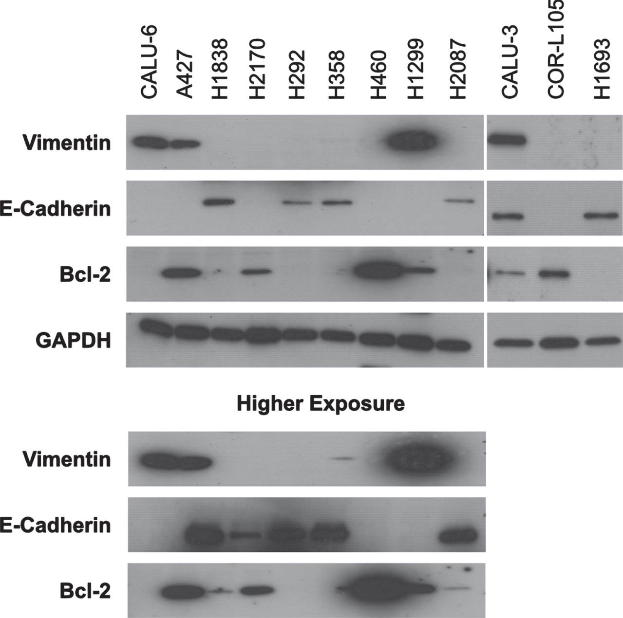 Epithelial-to-mesenchymal transition (EMT) and anti-apoptotic status of NSCLC cell lines. The basal expression of EMT markers vimentin and E-cadherin and the anti-apoptotic Bcl2 protein was analyzed by western blotting of the full panel of 12 NSCLC cell lines. Equal loading of protein was determined by GAPDH. For nine cell lines, high exposure time blots are shown as needed to confirm the expression of respective proteins. Western blot images are representative of two independent experiments.